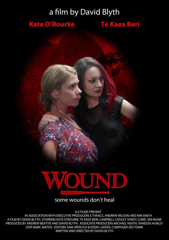 Wound images - Poster 5
